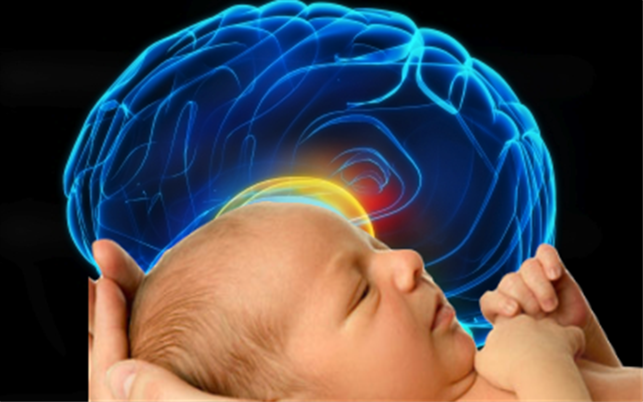 مغز نوزاد